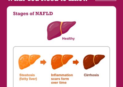 First ever Parliamentary Debate to address urgent issue of obesity-related liver disease in the UK