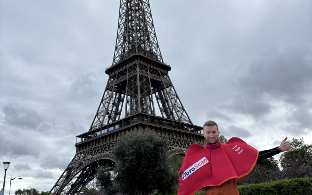 Camille to run London Marathon in liver costume to give a voice to the silent disease