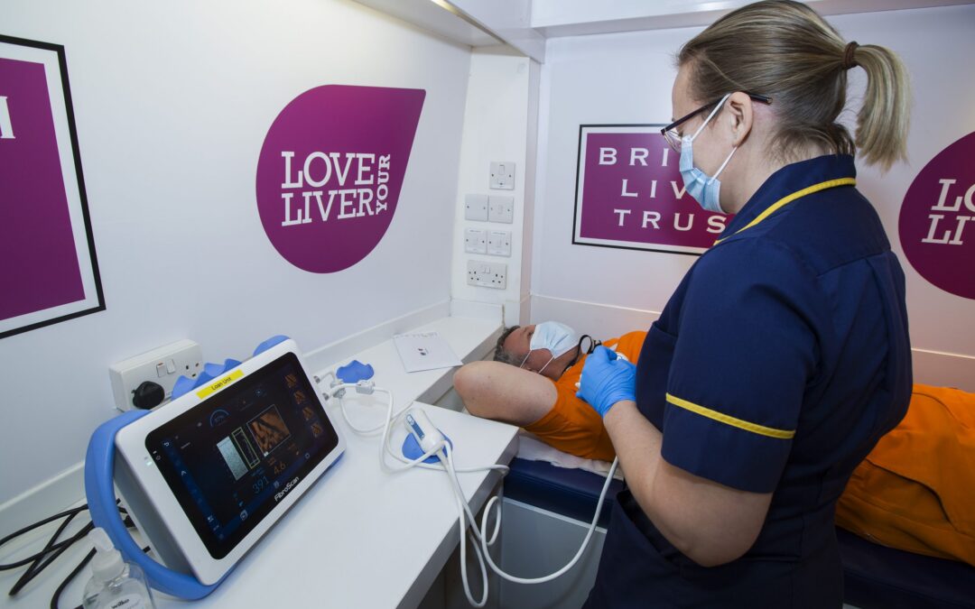 Love Your Liver roadshow update – finding those at risk of liver disease in the UK