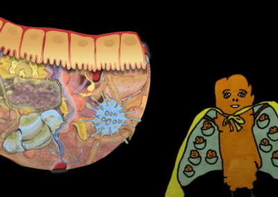 Attend The PROMISE Trial webinar: an innovative ‘Poo Transplant’ Trial to beat liver cirrhosis