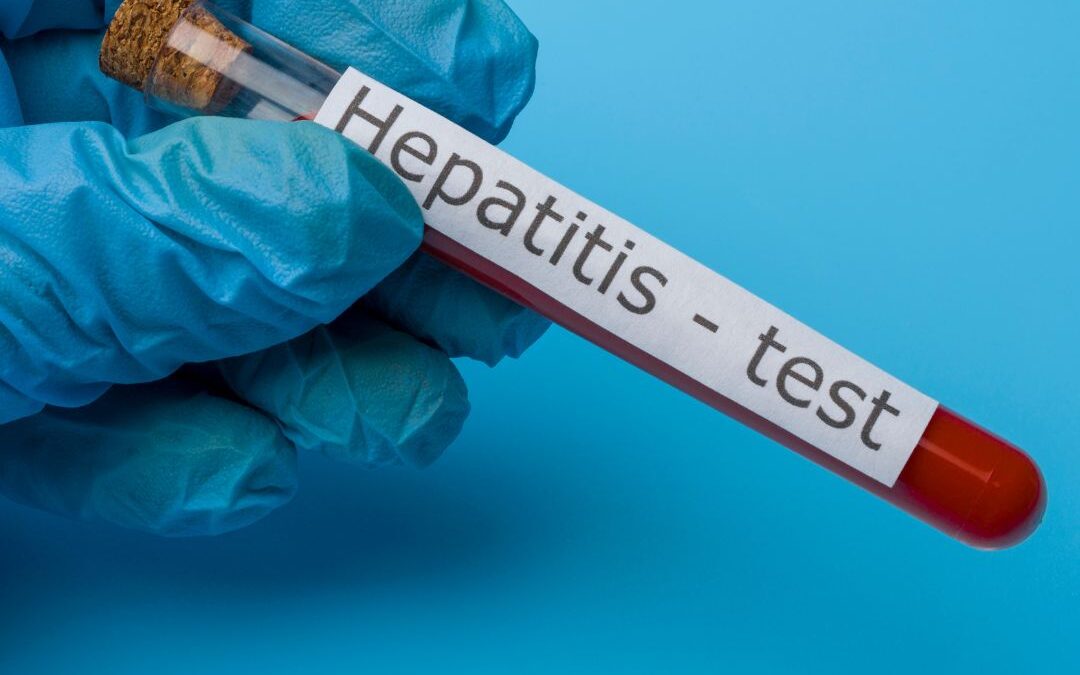 Record hepatitis testing in Wales as elimination efforts continue