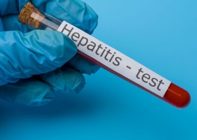 Record hepatitis testing in Wales as elimination efforts continue
