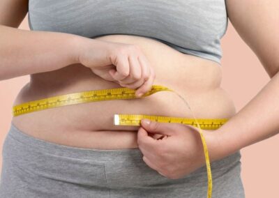 Obesity Health Alliance calls for levelling up of health inequalities